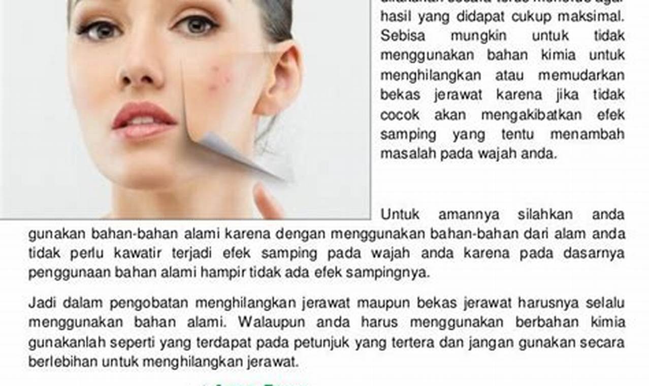 Cara Mengatasi Jerawat Dengan Cepat